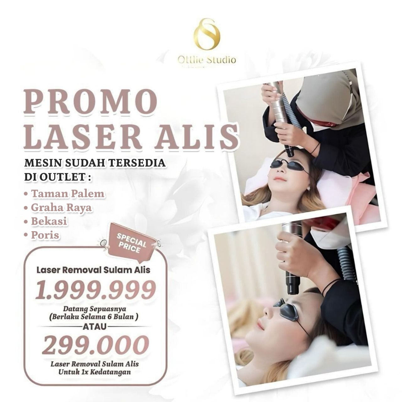 Laser Alis